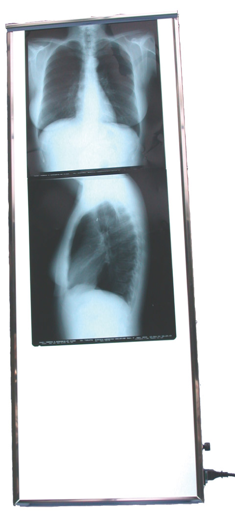 negatoscope vertical