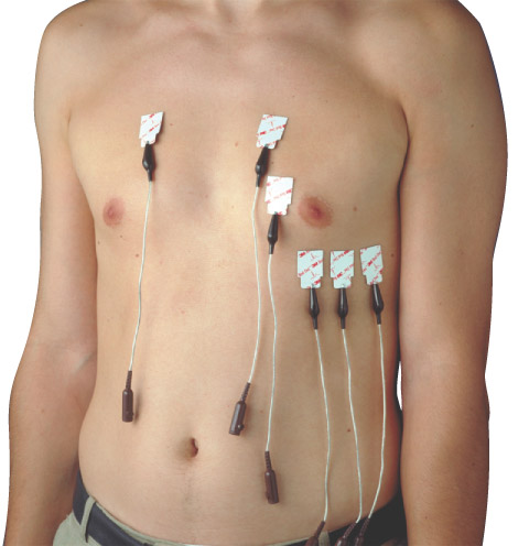 electrodes