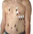electrodes